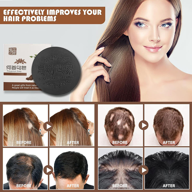 ⭐ Polygonum Multiflorum Anti-Mite Hair Soap – প্রাকৃতিক যত্নে নতুন চুলের অনুভূতি!